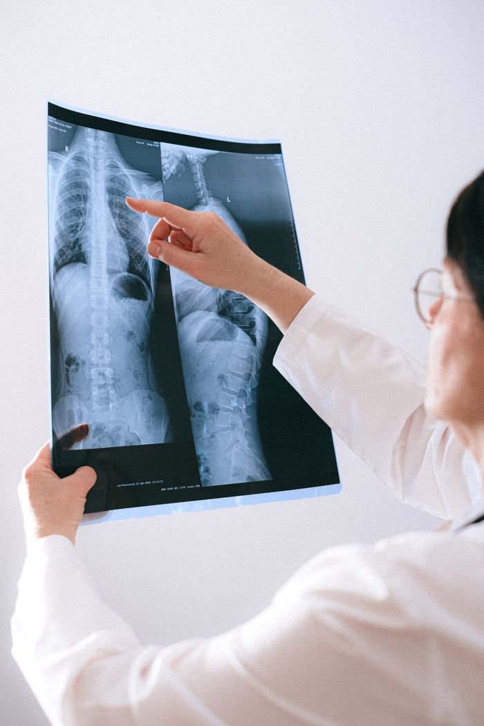 A doctor analyzing a spinal X-ray for medical diagnosis in a healthcare setting.